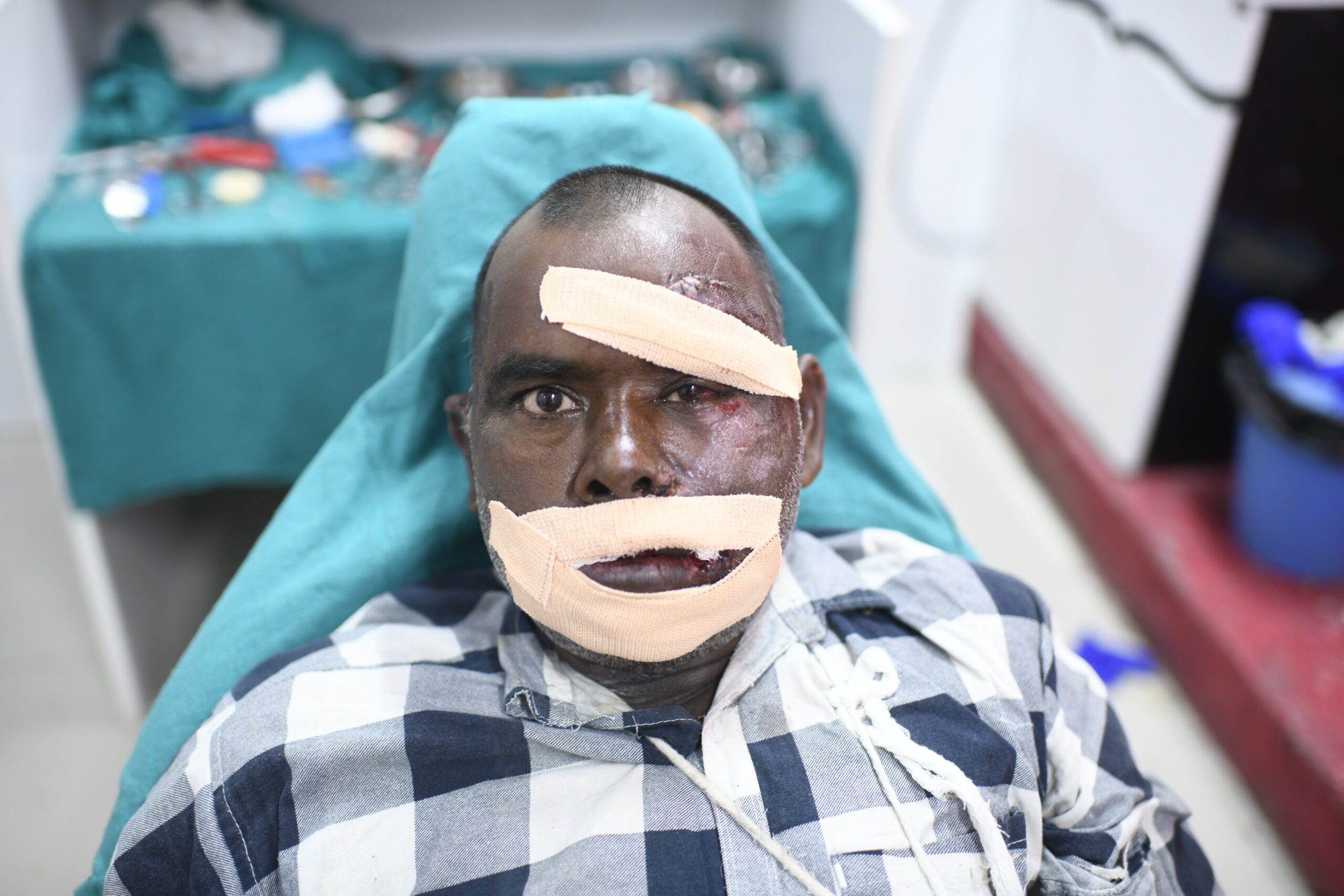 Fractures / endocare