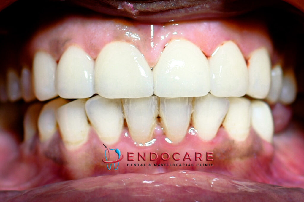 dental clinic in Lucknow